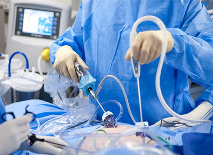 quistectomia_laparoscopica